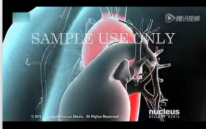 医学动画：主动脉解剖(国外)