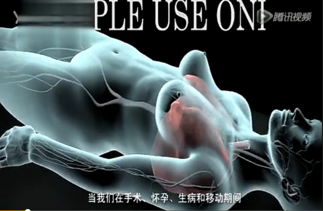 教学视频 深静脉血栓与肺栓塞