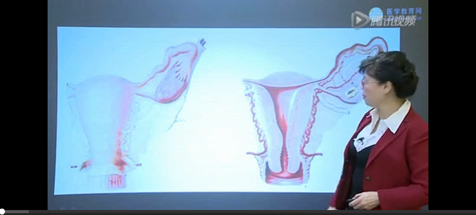 女性生殖系统--2014临床执业医师考前冲刺讲座