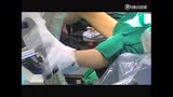 积水潭医院手术视频091228