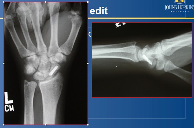 Screen Shot 2015-10-27 at 13.28.52.png