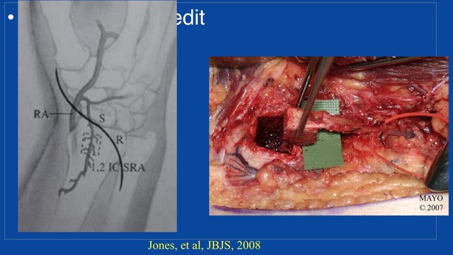 Screen Shot 2015-10-27 at 13.38.34.png