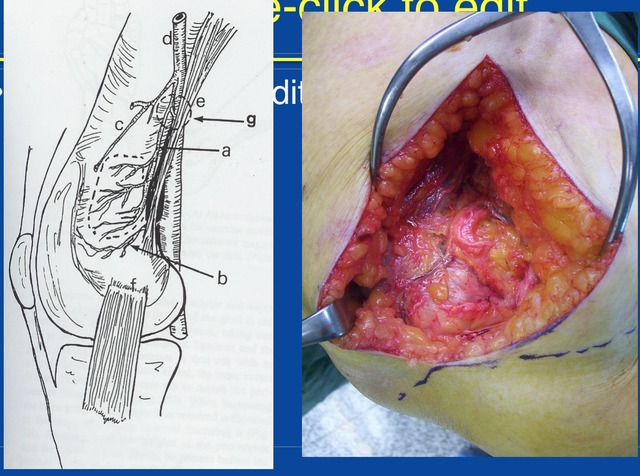 Screen Shot 2015-10-27 at 13.42.24.png