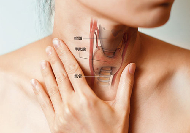 甲状腺切除术