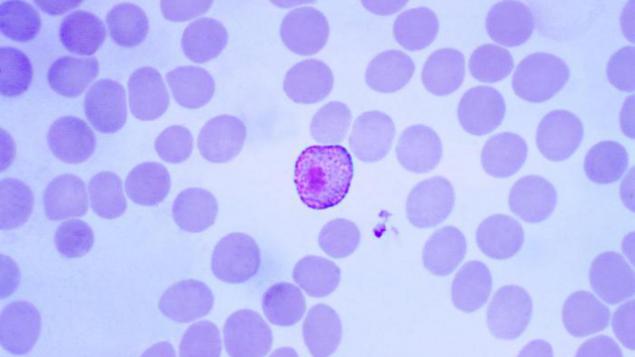 医学动画：疟原虫在人体内的生命周期