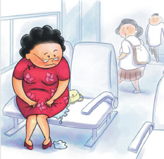 女性尿失禁如何预防