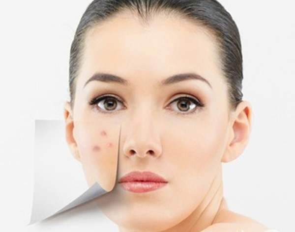 医学动画：带你了解痤疮