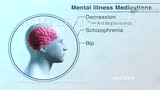 【医学动画】精神疾病的治疗方案